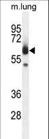 ZUFSP Antibody - ZUFSP Antibody western blot of mouse lung tissue lysates (35 ug/lane). The ZUFSP antibody detected the ZUFSP protein (arrow).