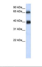 ZUFSP Antibody - Transfected 293T cell lysate. Antibody concentration: 1.0 ug/ml. Gel concentration: 12%.  This image was taken for the unconjugated form of this product. Other forms have not been tested.