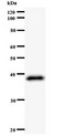 ZW10 Antibody - Western blot of immunized recombinant protein using ZW10 antibody.