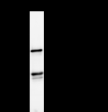 ZW10 Antibody - Immunoprecipitation: RIPA lysate of HeLa cells was incubated with anti-ZW10 mAb. Predicted molecular weight: 88 kDa