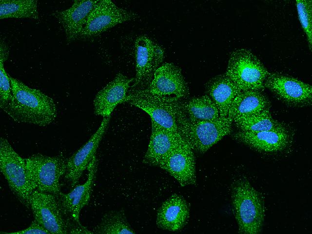 ZW10 Antibody - Immunofluorescence staining of ZW10 in U2OS cells. Cells were fixed with 4% PFA, permeabilzed with 0.1% Triton X-100 in PBS, blocked with 10% serum, and incubated with rabbit anti-Human ZW10 polyclonal antibody (dilution ratio 1:100) at 4°C overnight. Then cells were stained with the Alexa Fluor 488-conjugated Goat Anti-rabbit IgG secondary antibody (green) and counterstained with DAPI (blue). Positive staining was localized to Cytoplasm.