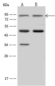 ZW10 Antibody - Anti-ZW10 rabbit polyclonal antibody at 1:500 dilution. Lane A: Jurkat Whole Cell Lysate. Lane B: U-251 MG Whole Cell Lysate. Lysates/proteins at 30 ug per lane. Secondary: Goat Anti-Rabbit IgG (H+L)/HRP at 1/10000 dilution. Developed using the ECL technique. Performed under reducing conditions. Predicted band size: 88 kDa. Observed band size: 90 kDa. (We are unsure as to the identity of these extra bands.)