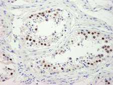 ZWINT Antibody - Detection of Human ZWINT-1 by Immunohistochemistry. Sample: FFPE section of human testis. Antibody: Affinity purified rabbit anti-ZWINT-1 used at a dilution of 1:250. Detection: DAB staining using anti-Rabbit IHC antibody at a dilution of 1:100.