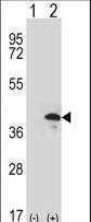 ZWINT Antibody - Western blot of ZWINT (arrow) using rabbit polyclonal ZWINT Antibody. 293 cell lysates (2 ug/lane) either nontransfected (Lane 1) or transiently transfected (Lane 2) with the ZWINT gene.