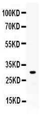 ZWINT Antibody - Western blot - Anti-ZWINT Picoband Antibody