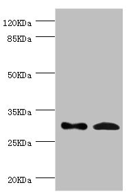 ZWINT Antibody - Western blot All Lanes:ZWINT antibody at 8.93ug/ml Lane 1:Hela whole cell lysate Lane 2:mouse liver tissue Secondary Goat polyclonal to rabbit at 1/10000 dilution Predicted band size: 32,26 kDa Observed band size: 31 kDa