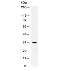 ZWINT Antibody - Western blot testing of rat skeletal muscle lysate with ZWINT antibody at 0.5ug/ml. Expected molecular weight ~31 kDa.