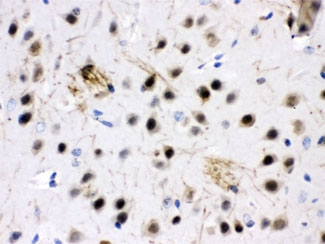 ZWINT Antibody - IHC testing of FFPE mouse brain with ZWINT antibody at 1ug/ml. HIER: steam in pH6 citrate buffer and allow to cool prior to staining.