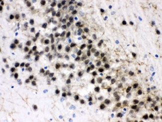 ZWINT Antibody - IHC testing of FFPE rat brain with ZWINT antibody at 1ug/ml. HIER: steam in pH6 citrate buffer and allow to cool prior to staining.