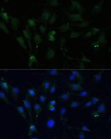 ZWINT Antibody - Immunofluorescence analysis of C6 cells using ZWINT Polyclonal Antibody at dilution of 1:100 (40x lens).Blue: DAPI for nuclear staining.