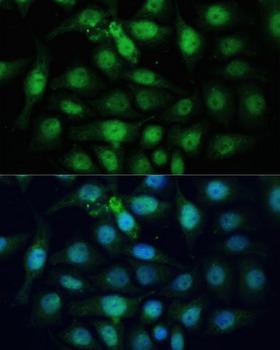 ZWINT Antibody - Immunofluorescence analysis of HeLa cells using ZWINT Polyclonal Antibody at dilution of 1:100 (40x lens).Blue: DAPI for nuclear staining.