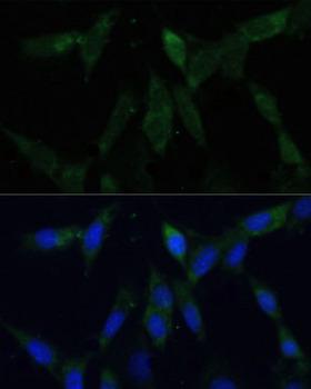ZWINT Antibody - Immunofluorescence analysis of NIH/3T3 cells using ZWINT Polyclonal Antibody at dilution of 1:100 (40x lens).Blue: DAPI for nuclear staining.