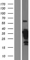 ZWINT Protein - Western validation with an anti-DDK antibody * L: Control HEK293 lysate R: Over-expression lysate