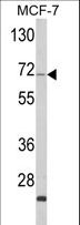 ZYG11A Antibody - Western blot of ZYG11A Antibody in MCF-7 cell line lysates (35 ug/lane). ZYG11A (arrow) was detected using the purified antibody.