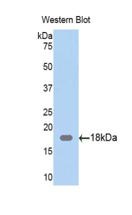 Zyxin Antibody - Western blot of recombinant Zyxin.  This image was taken for the unconjugated form of this product. Other forms have not been tested.
