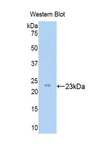 Zyxin Antibody - Western blot of recombinant Zyxin.  This image was taken for the unconjugated form of this product. Other forms have not been tested.