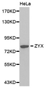 Zyxin Antibody - Western blot analysis of extracts of HeLa cell lines, using ZYX antibody.