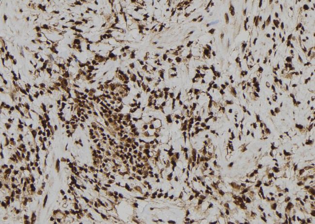 Zyxin Antibody - 1:100 staining human gastric tissue by IHC-P. The sample was formaldehyde fixed and a heat mediated antigen retrieval step in citrate buffer was performed. The sample was then blocked and incubated with the antibody for 1.5 hours at 22°C. An HRP conjugated goat anti-rabbit antibody was used as the secondary.
