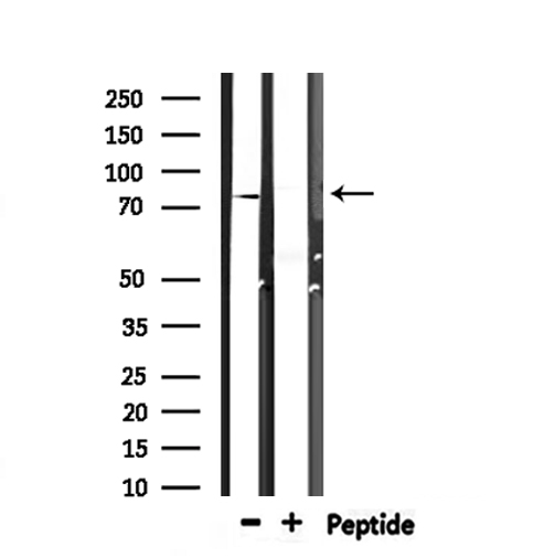 Zyxin Antibody - Western blot analysis of extracts of mouse muscle using ZYX antibody.