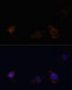 Zyxin Antibody - Immunofluorescence analysis of C6 cells using ZYX Polyclonal Antibody at dilution of 1:100.Blue: DAPI for nuclear staining.