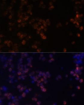 Zyxin Antibody - Immunofluorescence analysis of Raw264.7 cells using ZYX Polyclonal Antibody at dilution of 1:100.Blue: DAPI for nuclear staining.