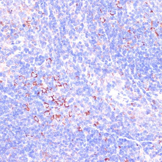 Zyxin Antibody - Immunohistochemistry of paraffin-embedded Mouse spleen using ZYX Polyclonal Antibody at dilution of 1:100 (40x lens).