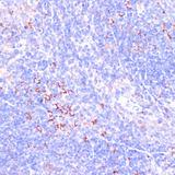 Zyxin Antibody - Immunohistochemistry of paraffin-embedded Mouse spleen using ZYX Polyclonal Antibody at dilution of 1:100 (40x lens).