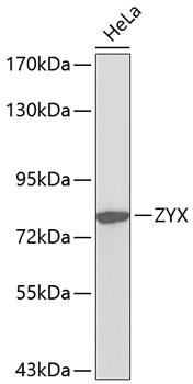 Zyxin Antibody - Western blot analysis of extracts of HeLa cells using ZYX Polyclonal Antibody.