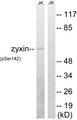 Zyxin Antibody - Western blot analysis of lysates from Jurkat cells treated with paclitaxel 1uM 24h, using Zyxin (Phospho-Ser142) Antibody. The lane on the right is blocked with the phospho peptide.