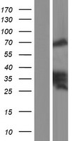 Zyxin Protein - Western validation with an anti-DDK antibody * L: Control HEK293 lysate R: Over-expression lysate